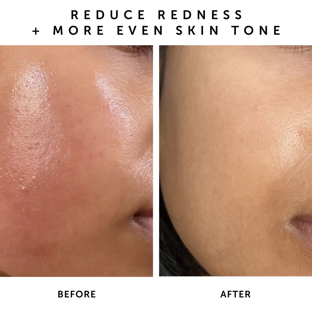 NOVA 15% Vitamin C & Turmeric Brightening Serum