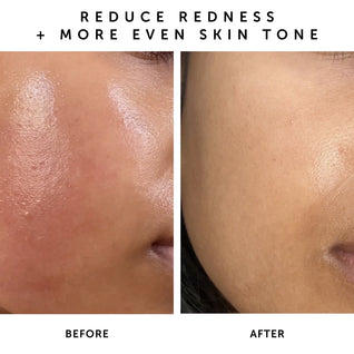 NOVA 15% Vitamin C & Turmeric Brightening Serum